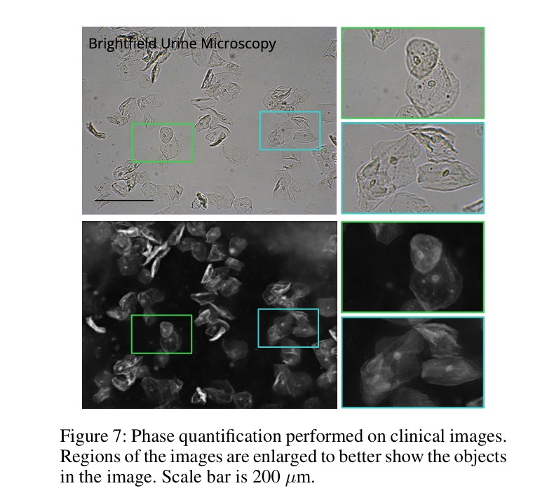 Single Exposure Quantitative Phase Imaging with a Conventional Microscope using Diffusion Models