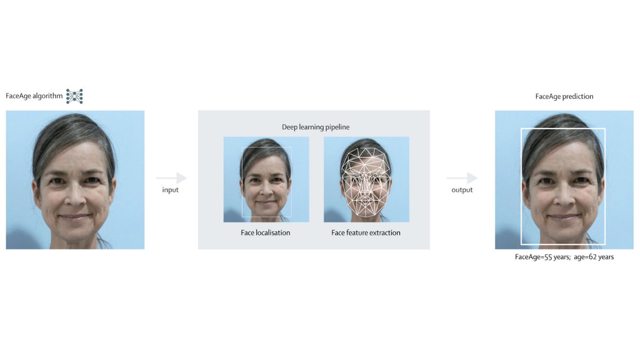 FaceAge, a deep learning system to estimate biological age from face photographs to improve prognostication: a model development and validation study