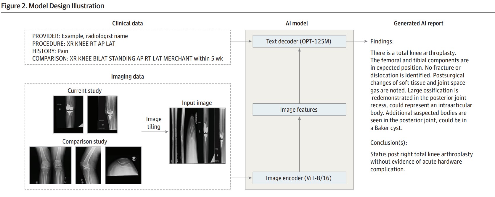 Efficiency and Quality of Generative AIAssisted Radiograph Reporting