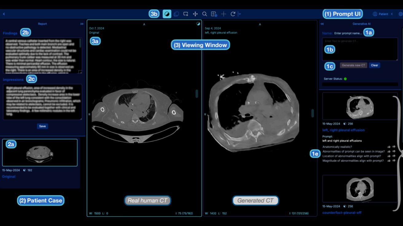 A Human-Centered Approach to Identifying Promises, Risks, & Challenges of Text-to-Image Generative AI in Radiology