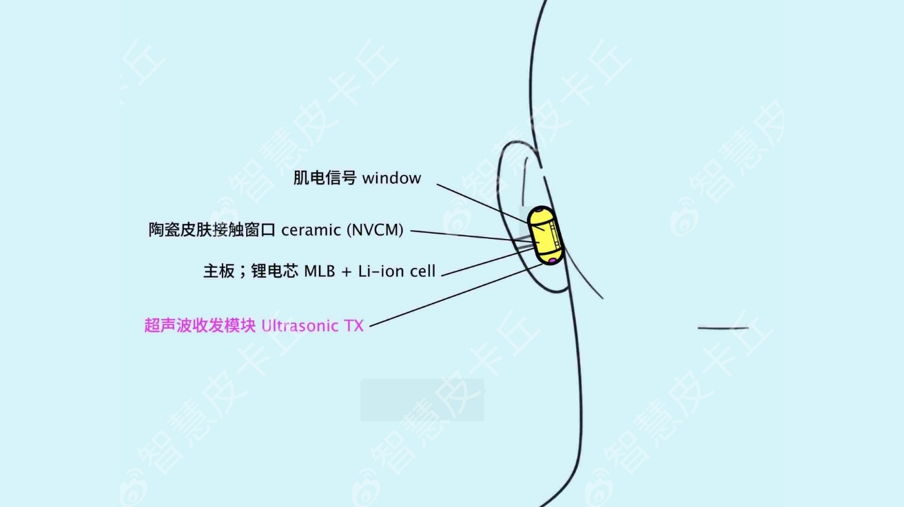오픈AI, 에어팟 대항할 오디오 기기 '스위트피' 개발 중… 올해 9월 출시 목표